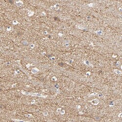 Invitrogen SLC10A2 Polyclonal Antibody 100 &mu;L; Unconjugated:Antibodies,