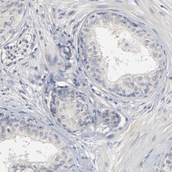 Invitrogen SLC10A2 Polyclonal Antibody 100 &mu;L; Unconjugated:Antibodies,
