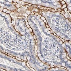 Invitrogen SLC10A2 Polyclonal Antibody 100 &mu;L; Unconjugated:Antibodies,