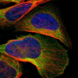 Invitrogen C1orf198 Polyclonal Antibody 100 &mu;L; Unconjugated:Antibodies,