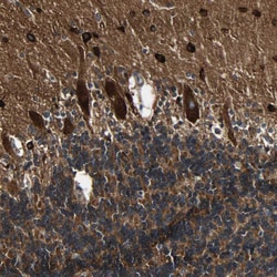 Invitrogen C1orf198 Polyclonal Antibody 100 &mu;L; Unconjugated:Antibodies,