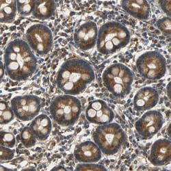 Invitrogen C1orf198 Polyclonal Antibody 100 &mu;L; Unconjugated:Antibodies,