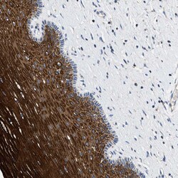 Invitrogen TOMM6 Polyclonal Antibody 100 &mu;L; Unconjugated:Antibodies,