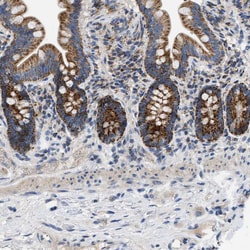 Invitrogen TOMM6 Polyclonal Antibody 100 &mu;L; Unconjugated:Antibodies,