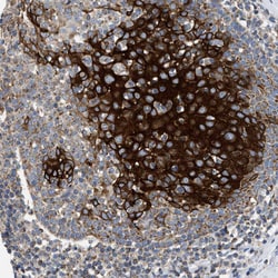 Invitrogen TOMM6 Polyclonal Antibody 100 &mu;L; Unconjugated:Antibodies,