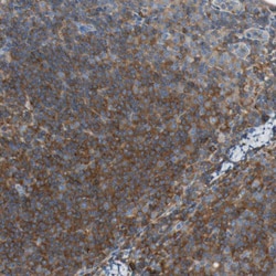 Invitrogen p41-ARCb Polyclonal Antibody 100 &mu;L; Unconjugated:Antibodies,