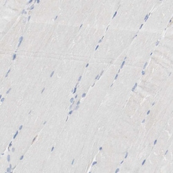 Invitrogen p41-ARCb Polyclonal Antibody 100 &mu;L; Unconjugated:Antibodies,