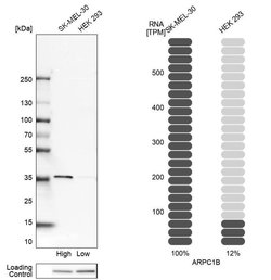 Invitrogen p41-ARCb Polyclonal Antibody 100 &mu;L; Unconjugated:Antibodies,