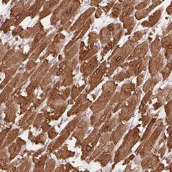 Invitrogen HRC Polyclonal Antibody 100 &mu;L; Unconjugated:Antibodies,