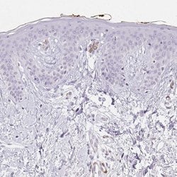 Invitrogen HRC Polyclonal Antibody 100 &mu;L; Unconjugated:Antibodies,