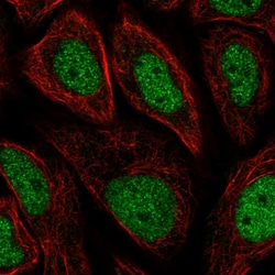 Invitrogen GTF2H3 Polyclonal Antibody 100 &mu;L; Unconjugated:Antibodies,