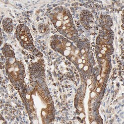 Invitrogen ZMAT5 Polyclonal Antibody 100 &mu;L; Unconjugated:Antibodies,