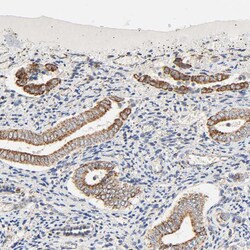 Invitrogen ZMAT5 Polyclonal Antibody 100 &mu;L; Unconjugated:Antibodies,