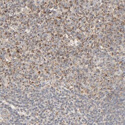 Invitrogen ZMAT5 Polyclonal Antibody 100 &mu;L; Unconjugated:Antibodies,