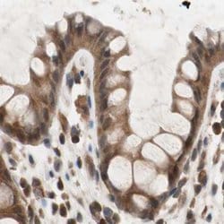 Invitrogen GALT Polyclonal Antibody 100 &mu;L; Unconjugated:Antibodies,