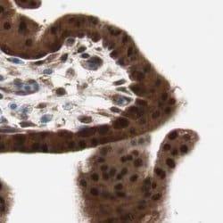 Invitrogen GALT Polyclonal Antibody 100 &mu;L; Unconjugated:Antibodies,