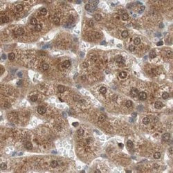 Invitrogen GALT Polyclonal Antibody 100 &mu;L; Unconjugated:Antibodies,