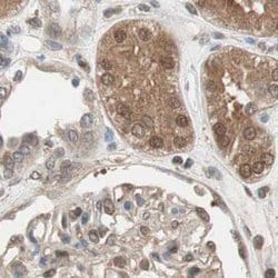 Invitrogen GALT Polyclonal Antibody 100 &mu;L; Unconjugated:Antibodies,