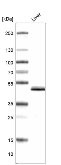 Invitrogen GALT Polyclonal Antibody 100 &mu;L; Unconjugated:Antibodies,