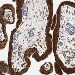 Invitrogen GALT Polyclonal Antibody 100 &mu;L; Unconjugated:Antibodies,