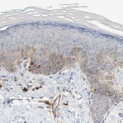 Invitrogen MFI2 Polyclonal Antibody 100 &mu;L; Unconjugated:Antibodies,