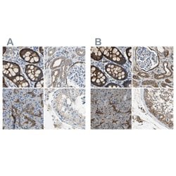 Invitrogen Filamin B Polyclonal Antibody 100 &mu;L; Unconjugated:Antibodies,