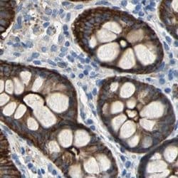 Invitrogen Filamin B Polyclonal Antibody 100 &mu;L; Unconjugated:Antibodies,