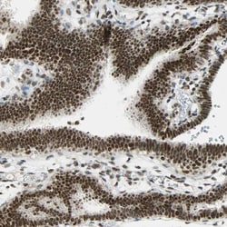 Invitrogen SUGP1 Polyclonal Antibody 100 &mu;L; Unconjugated:Antibodies,
