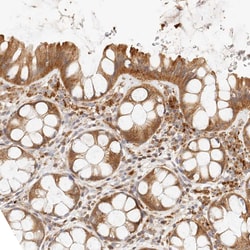 Invitrogen PTPN22 Polyclonal Antibody 100 &mu;L; Unconjugated:Antibodies,