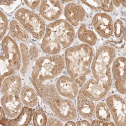 Invitrogen PTPN22 Polyclonal Antibody 100 &mu;L; Unconjugated:Antibodies,