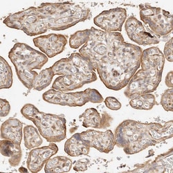 Invitrogen PTPN22 Polyclonal Antibody 100 &mu;L; Unconjugated:Antibodies,