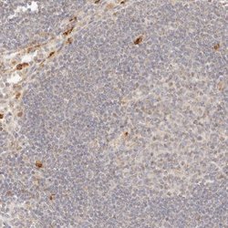 Invitrogen PTPN22 Polyclonal Antibody 100 &mu;L; Unconjugated:Antibodies,