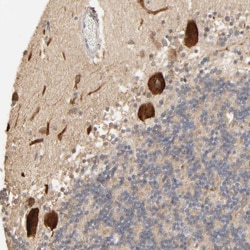 Invitrogen CLEC4E Polyclonal Antibody 100 &mu;L; Unconjugated:Antibodies,