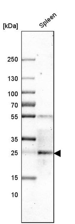 Invitrogen CLEC4E Polyclonal Antibody 100 &mu;L; Unconjugated:Antibodies,