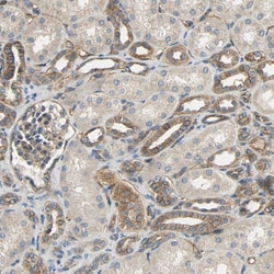 Invitrogen KIAA1217 Polyclonal Antibody 100 &mu;L; Unconjugated:Antibodies