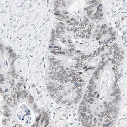 Invitrogen ARID1A Polyclonal Antibody 100 &mu;L; Unconjugated:Antibodies,