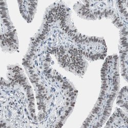 Invitrogen ARID1A Polyclonal Antibody 100 &mu;L; Unconjugated:Antibodies,