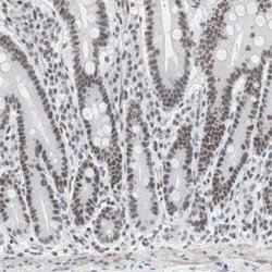 Invitrogen ARID1A Polyclonal Antibody 100 &mu;L; Unconjugated:Antibodies,