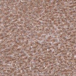 Invitrogen SEC31A Polyclonal Antibody 100 &mu;L | Buy Online | Invitrogen&trade; | Fisher Scientific