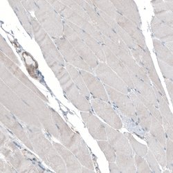 Invitrogen SEC31A Polyclonal Antibody 100 &mu;L | Buy Online | Invitrogen&trade; | Fisher Scientific