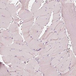 Invitrogen FMNL2 Polyclonal Antibody 100 &mu;L; Unconjugated:Antibodies,