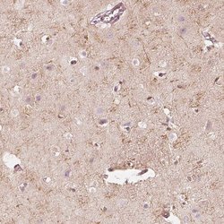Invitrogen FMNL2 Polyclonal Antibody 100 &mu;L; Unconjugated:Antibodies,