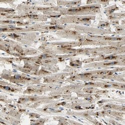 Invitrogen ASAH1 Polyclonal Antibody 100 &mu;L; Unconjugated:Antibodies,