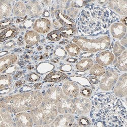Invitrogen ASAH1 Polyclonal Antibody 100 &mu;L; Unconjugated:Antibodies,