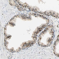 Invitrogen ASAH1 Polyclonal Antibody 100 &mu;L; Unconjugated:Antibodies,