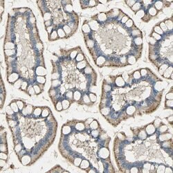 Invitrogen ASAH1 Polyclonal Antibody 100 &mu;L; Unconjugated:Antibodies,
