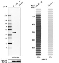 Invitrogen ASAH1 Polyclonal Antibody 100 &mu;L; Unconjugated:Antibodies,