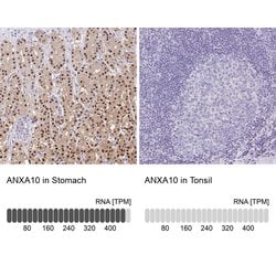Invitrogen Annexin A10 Polyclonal Antibody 100 &mu;L; Unconjugated:Antibodies,