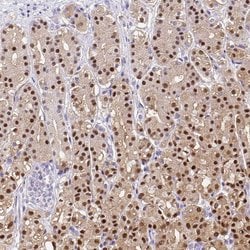 Invitrogen Annexin A10 Polyclonal Antibody 100 &mu;L; Unconjugated:Antibodies,