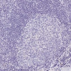 Invitrogen Annexin A10 Polyclonal Antibody 100 &mu;L; Unconjugated:Antibodies,